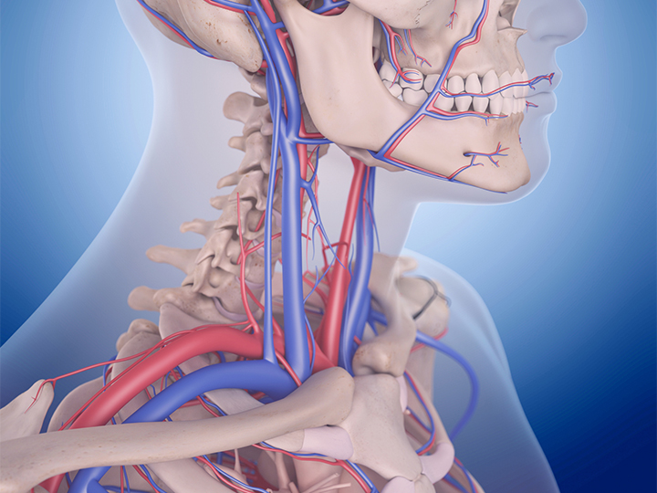 Raising Awareness on World Stroke Day: Carotid Artery Disease, the Silent Threat