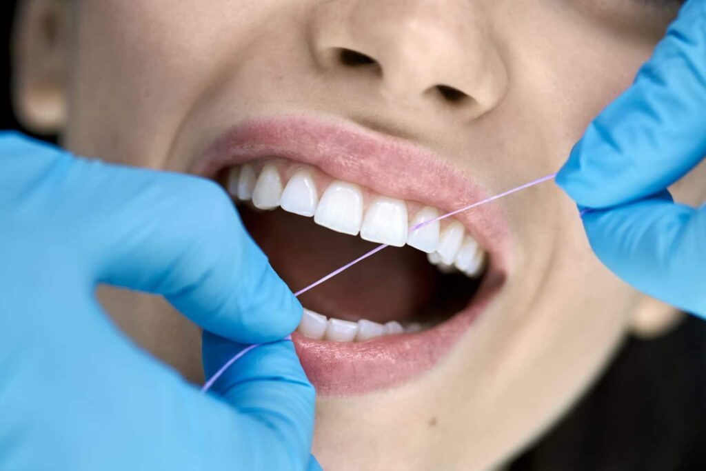 How Often Should You Schedule Dental Checkups?