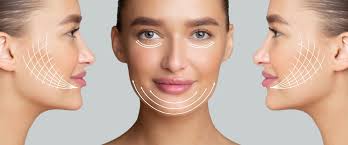 The Benefits of a Facelift in Dubai: Your Path to Timeless Beauty Facelift